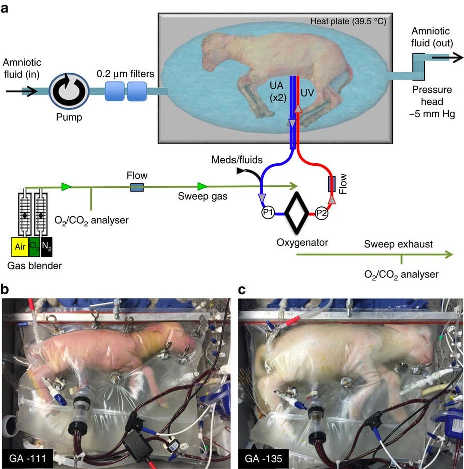 Artificial Womb