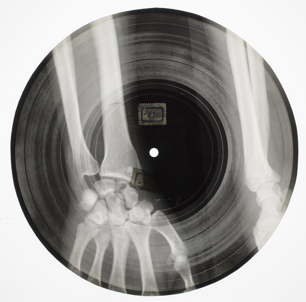 a Soviet record made from a used x-ray film