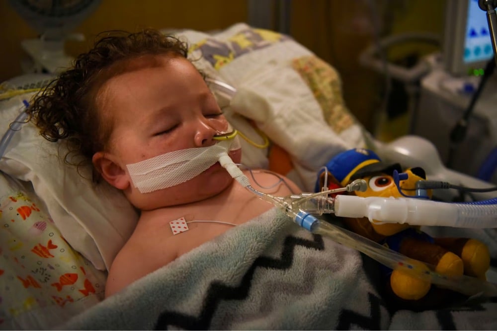 a young child with Covid on a respirator