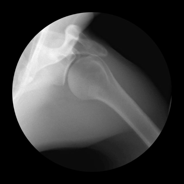 x-ray GIF