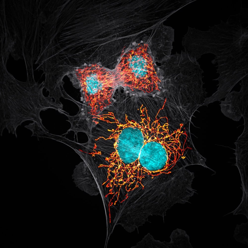 Photomicrography Contest 2019