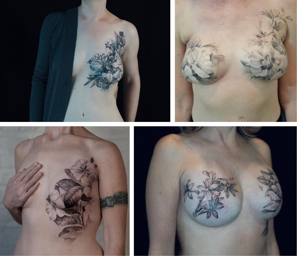 Postmastectomy Tattoos