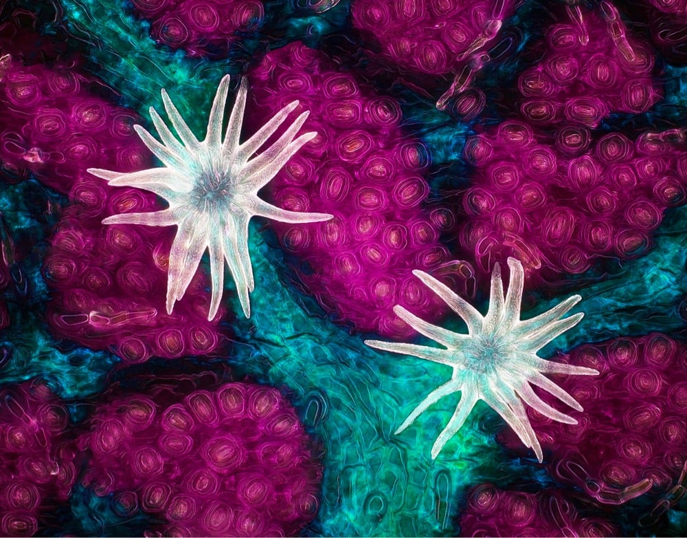 Trichome (white appendages) and stomata (purple pores) on a southern live oak leaf